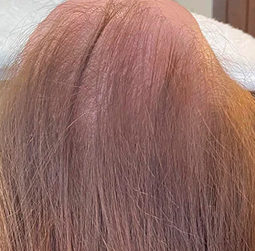 Before/After Image